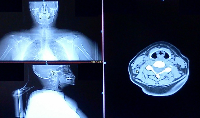 Ct Scan